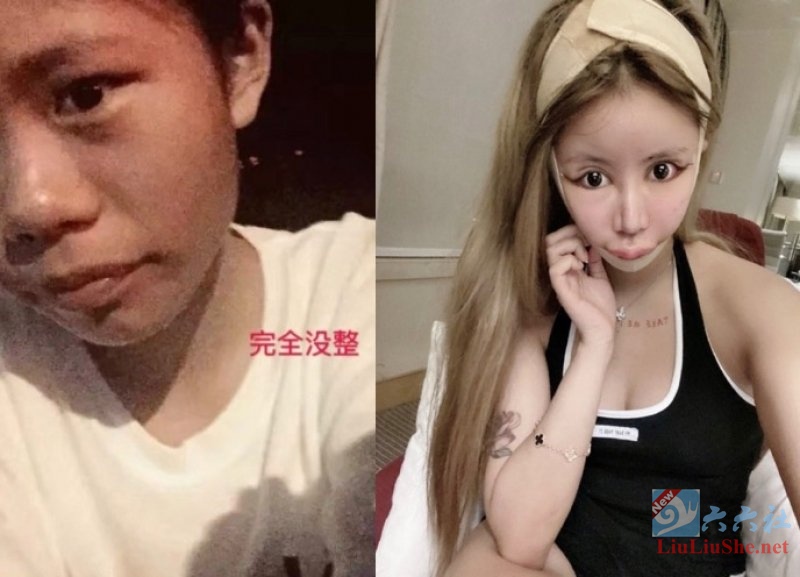 想红想疯了！网红「小z娜娜Nana」整形60次-星玉馆