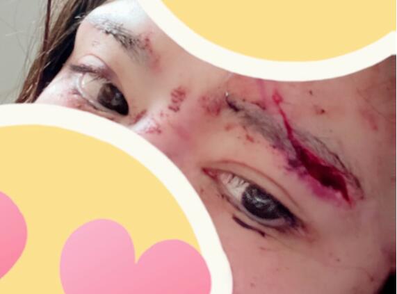 图片[2]-辻井ほのか（辻井穗乃果）发生交通事故，毁容？-星玉馆