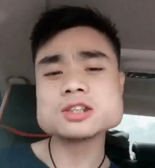 槟榔嚼多了脸会变方吗？-星玉馆